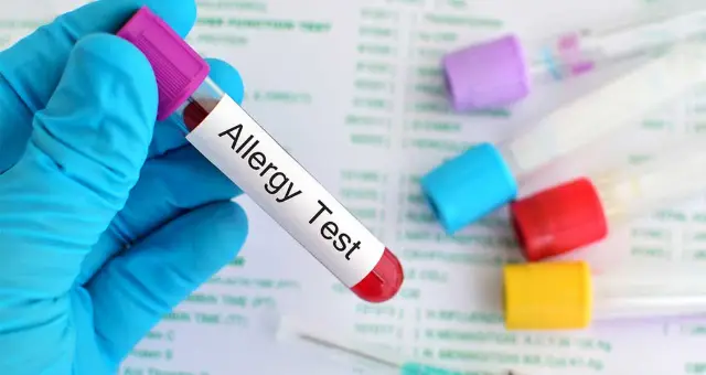 Blood sample tube labelled allergy test