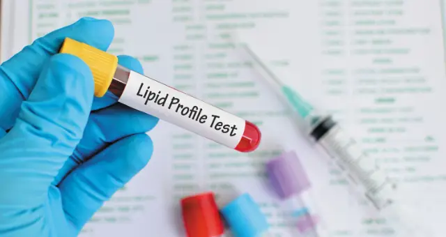 Blood sample tube labelled lipid profile test