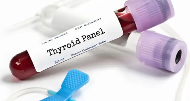 Blood sample tube labelled thyroid panel