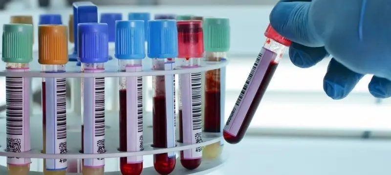 Labelled blood sample tubes in a laboratory rack